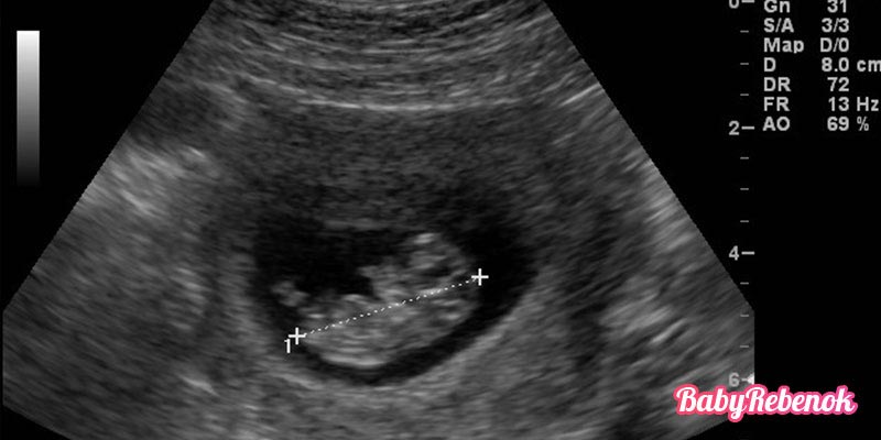10 неделя беременности: фото, животик, УЗИ, ощущения