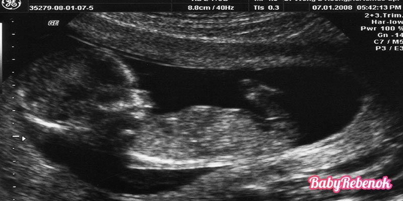 14 неделя беременности: фото, животик, УЗИ, ощущения