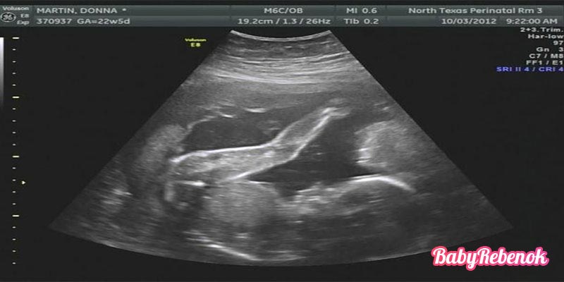 22 неделя беременности: УЗИ, шевеления, фото живота и плода
