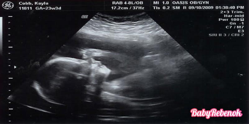 23 неделя беременности: фото, животик, УЗИ, ощущения