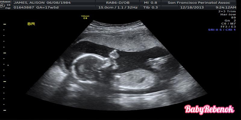 25 неделя беременности: фото, животик, УЗИ, ощущения
