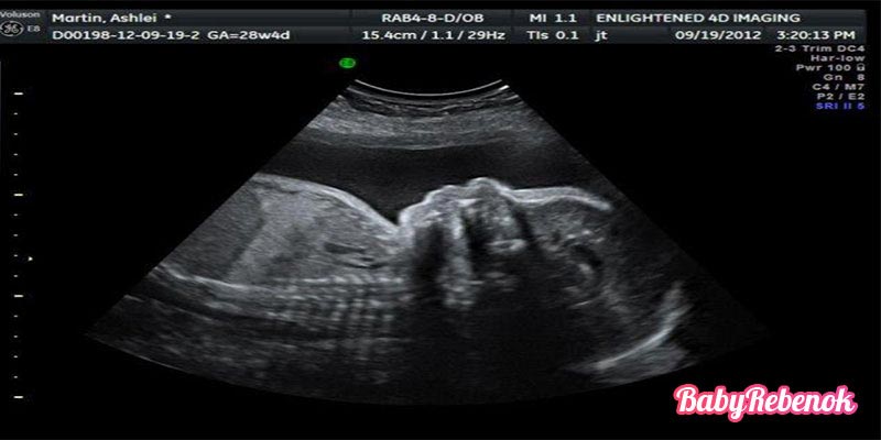 28 неделя беременности: шевеления, фото животиков, УЗИ