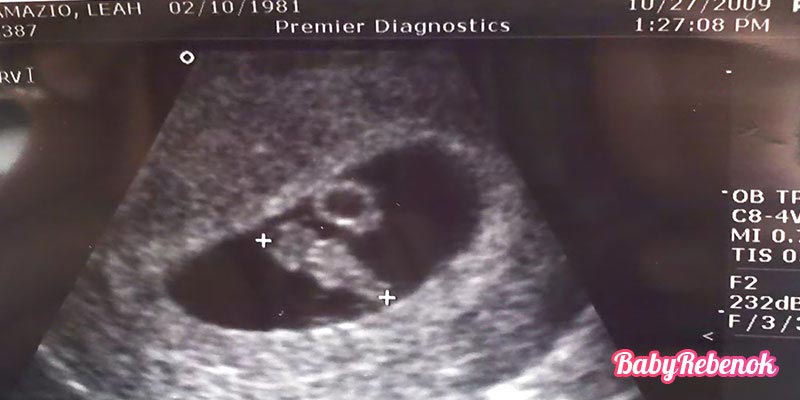 7 неделя беременности: фото, живот, УЗИ, ощущения