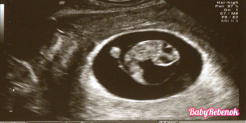 8 неделя беременности: ощущения, УЗИ, фото животиков