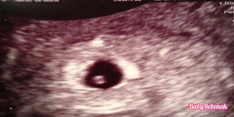5 неделя беременности: ощущения, симптомы, признаки, фото