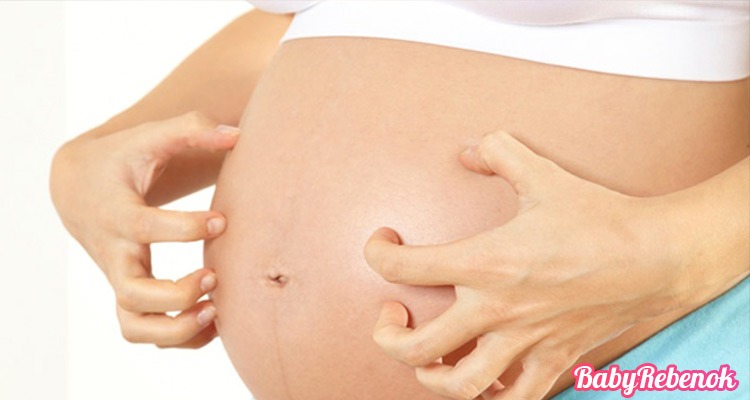 Зуд при беременности. Чешется живот, грудь, влагалище, тело