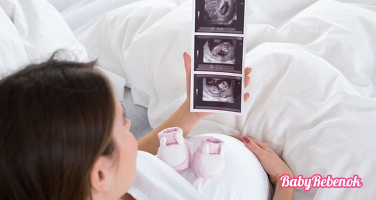Клинический и анатомический узкий таз при беременности